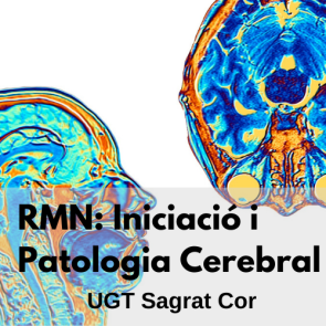 RMN: Iniciació i Patologia Cerebral - UGT Sagrat Cor (Edició 2)